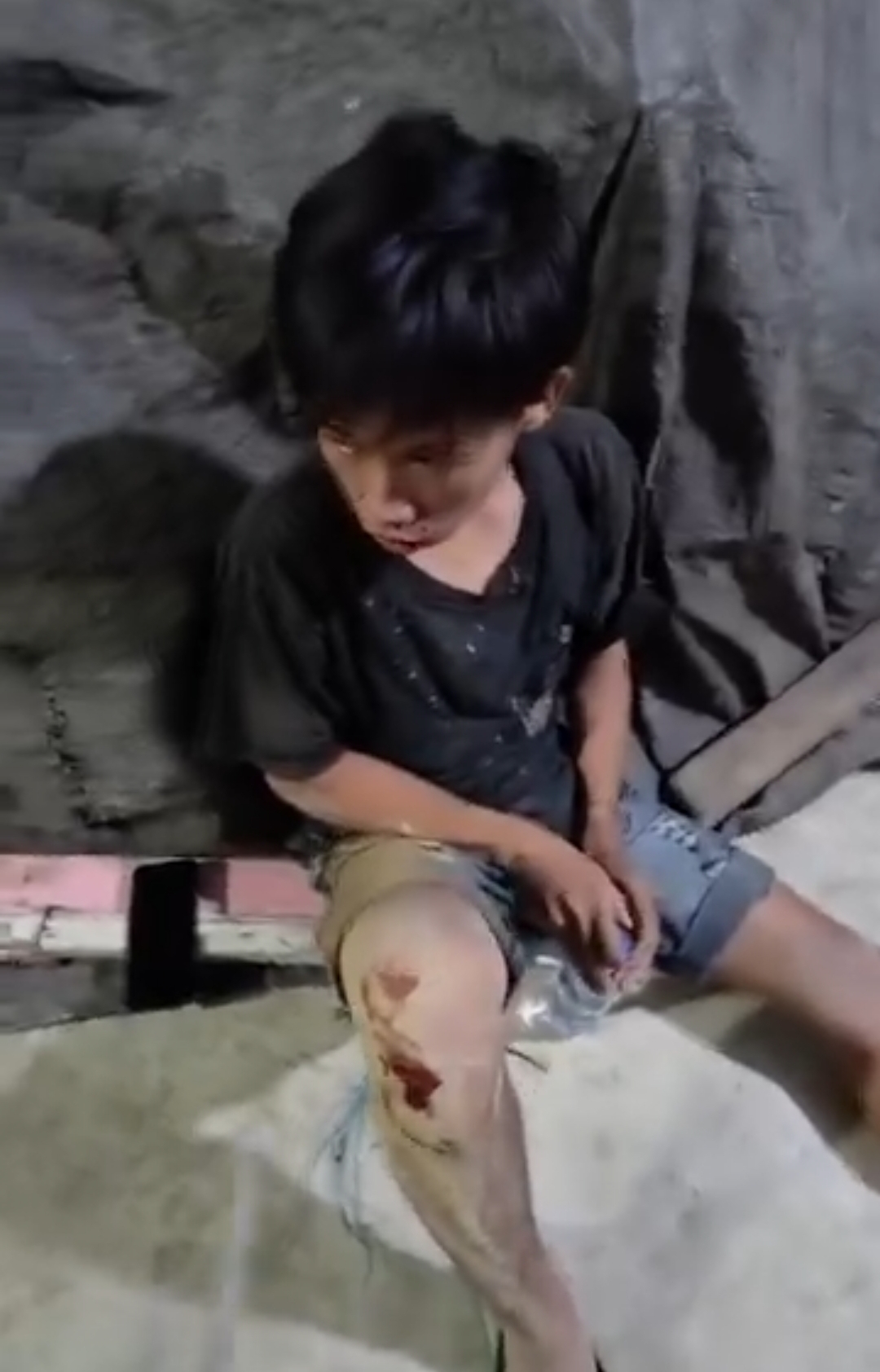 Salah satu korban begal di Sekatak alami luka- luka di bagian kaki